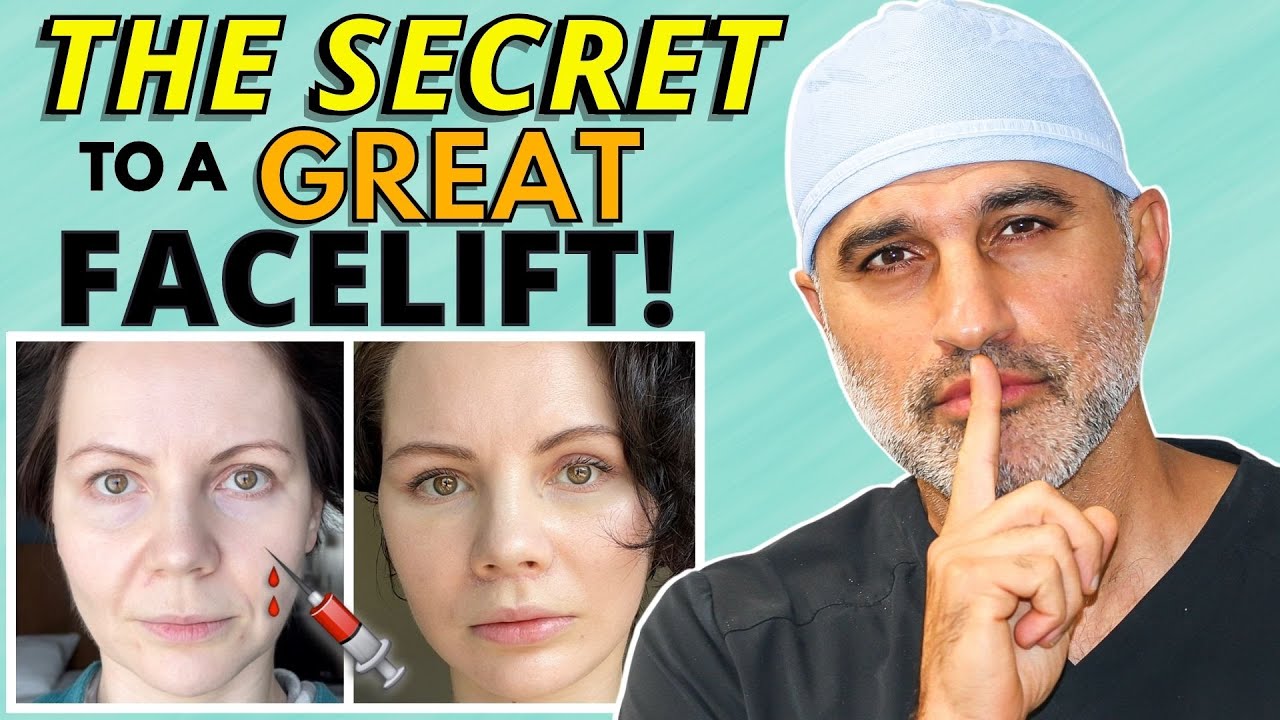 Will you need a fat transfer along with your facelift?