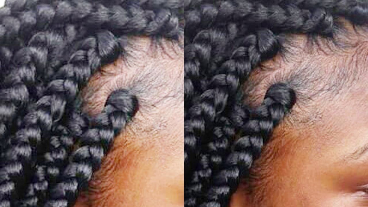 Tips and Tricks: Gripping The Roots| Rubber Band Method|Box Braid Like A Pro part 4