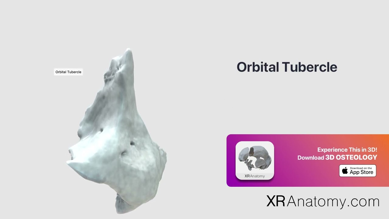Orbital Tubercle of Zygomatic Bone