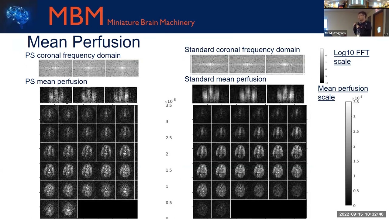 MRI Perfusion Imaging with Partial Separability