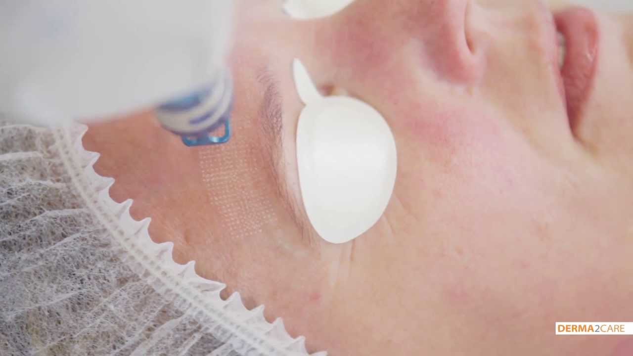 Huidverjonging & huidverbetering - De Huidkliniek