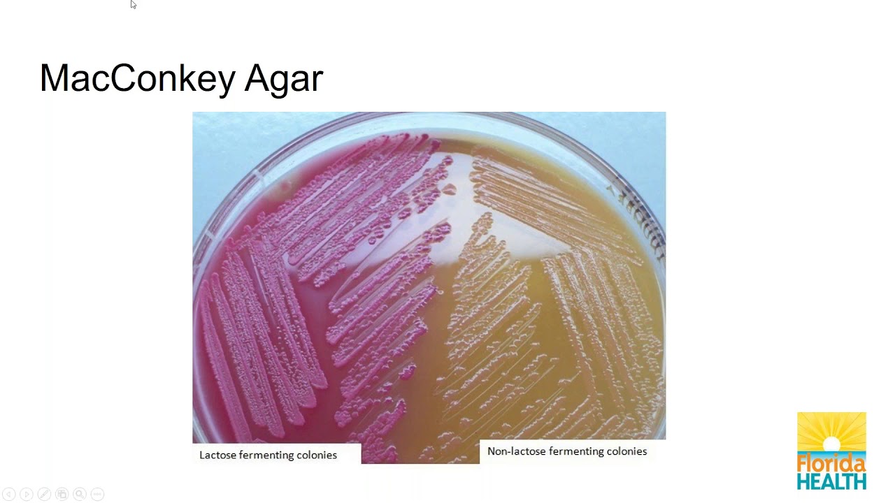 Florida HAI CIC Study Group  Enterobacteriaceae, Legionella, and Hepatitis