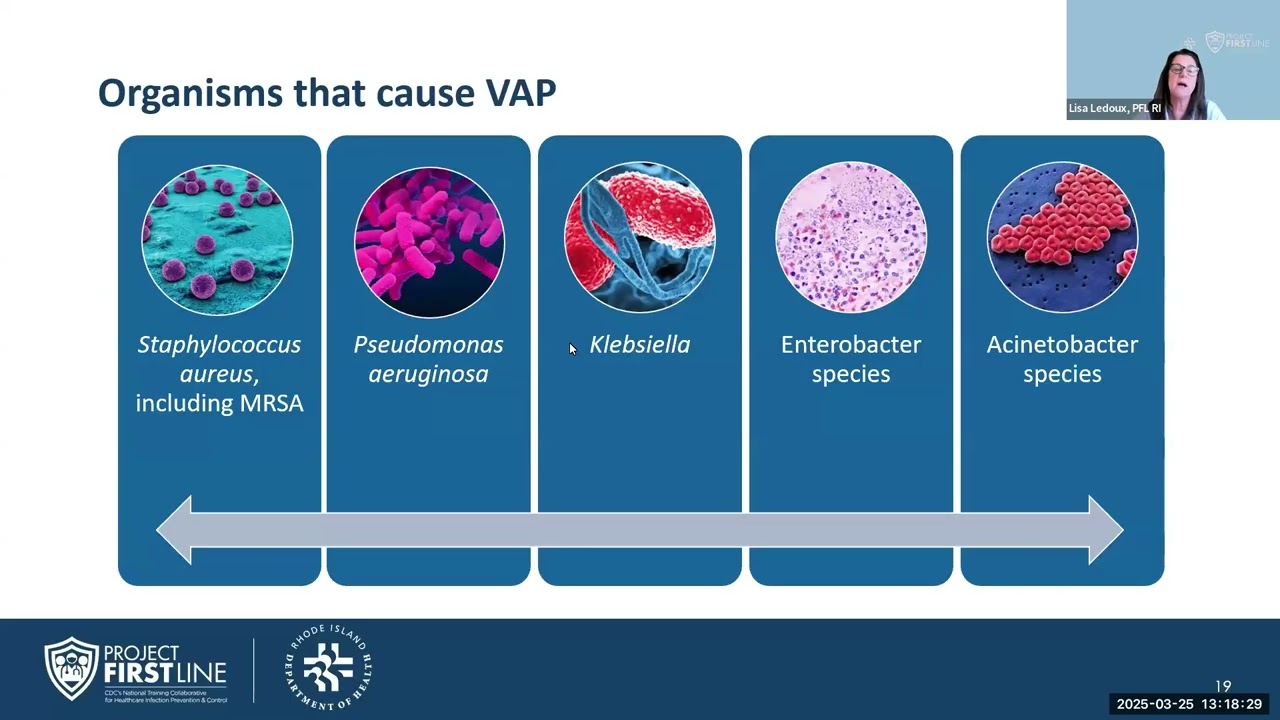 Preventing Healthcare-Associated Infections: Ventilator-Associated Events (VAE)