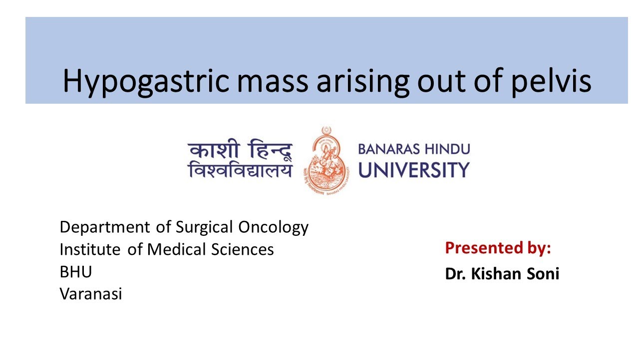 Hypogastric mass arising out of pelvis
