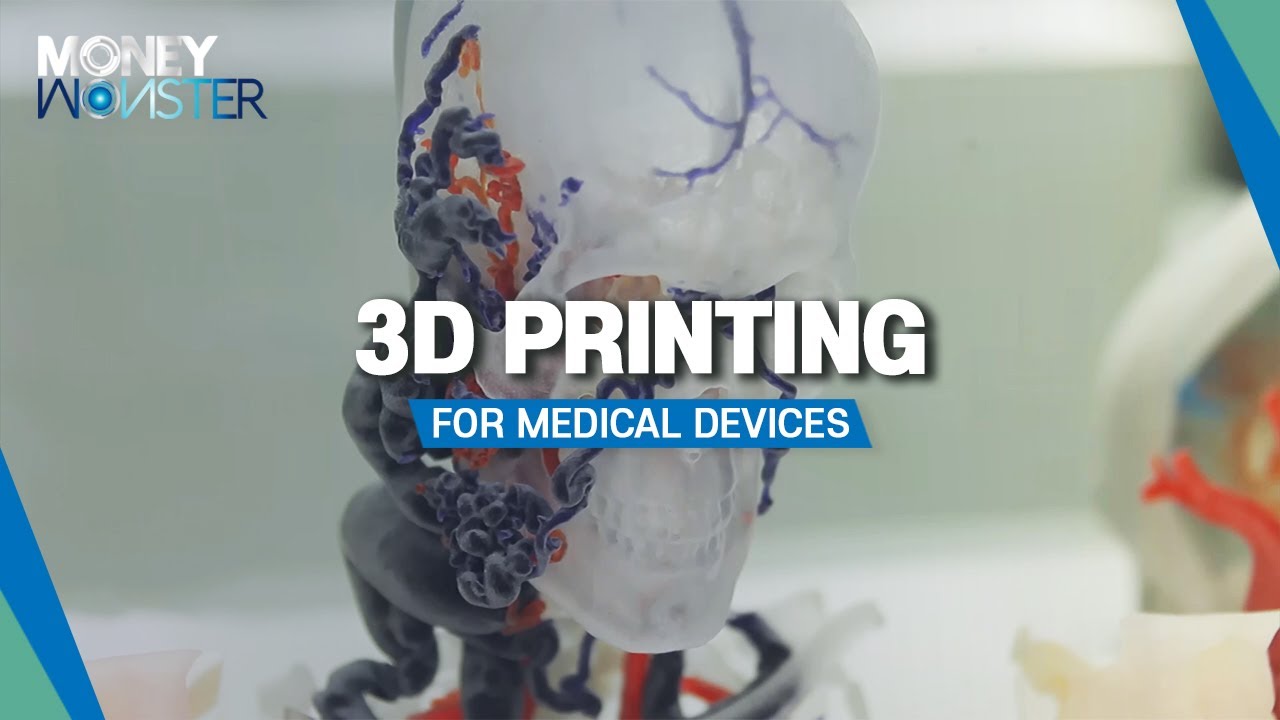 [Money Monster] 3D printing for medical devices