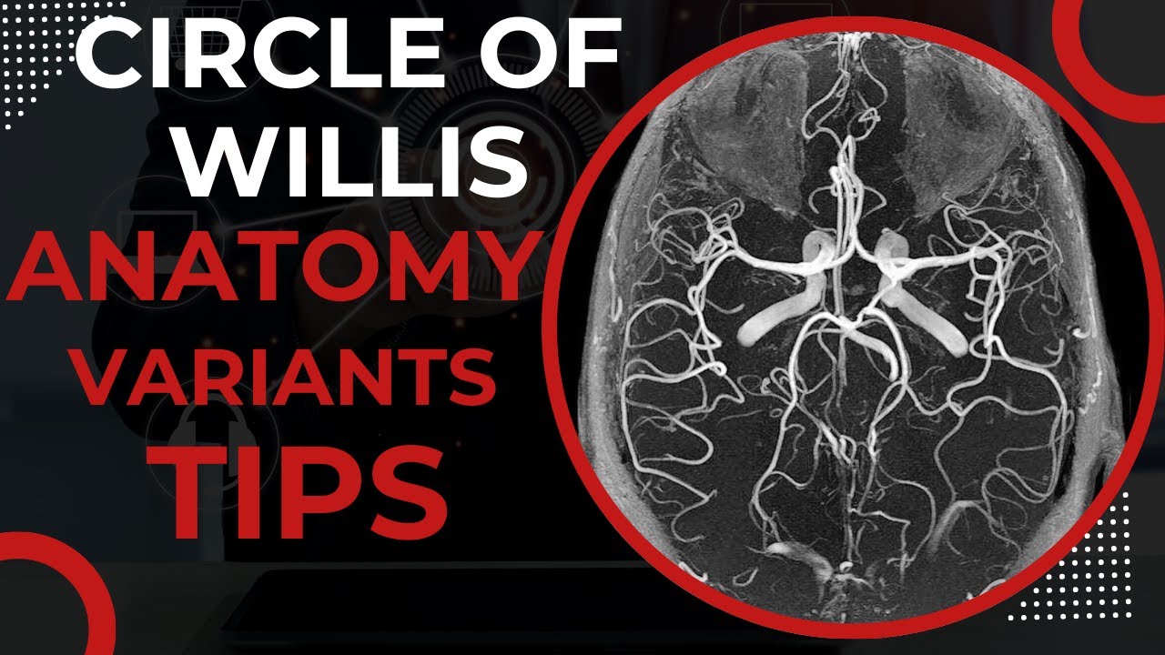 Circle of Willis - Anatomy and Variants