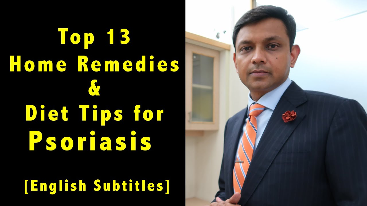 Top 13 Home Remedies & Diet Tips for Psoriasis