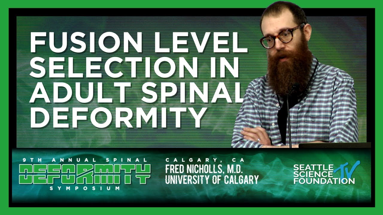 Fusion Level Selection in Adult Spinal Deformity - Fred Nicholls, M.D.
