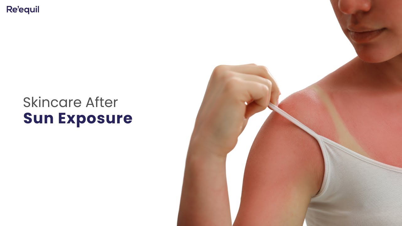 Skincare After Sun Exposure