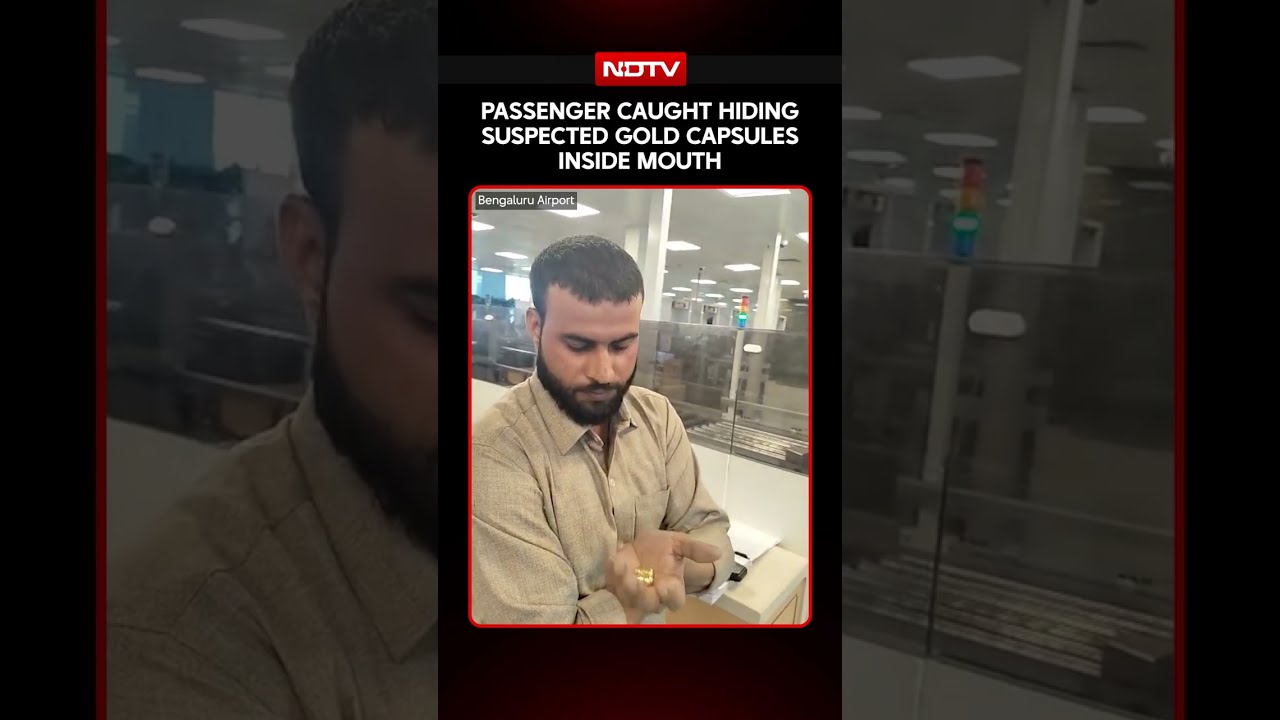 Bengaluru News | Dubai Passenger Held At Bengaluru Airport With Suspected Gold Capsules in Mouth