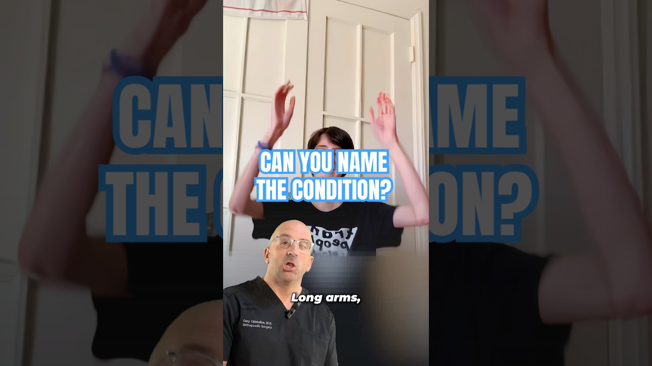 Learn the HIDDEN Signs of Marfan Syndrome⁉️