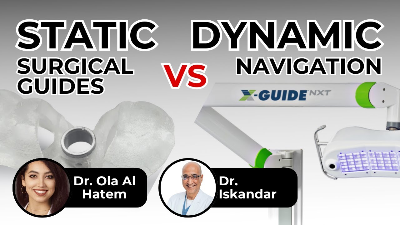 Static Surgical Guides Vs Dynamic Navigation - ep 0050