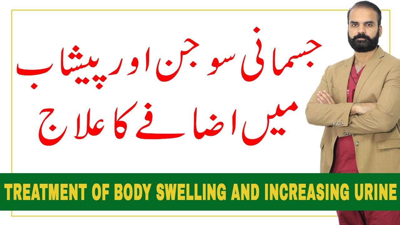 Treatment of Body Swelling and increasing urine 【Edema in Urdu Hindi】