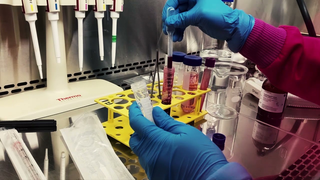 Peripheral Blood Mononuclear Cell Isolation