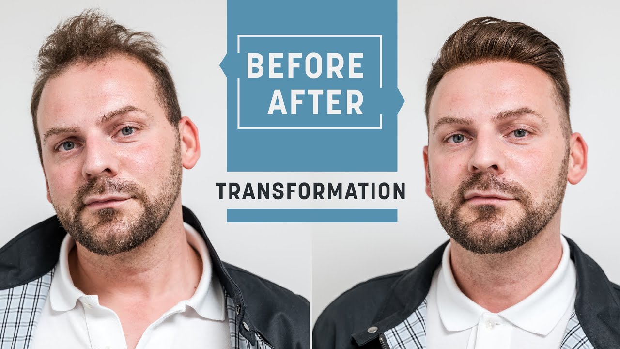 Extreme makeover through hair replacement | Transformation with a hairsystem | Hairsystems Heydecke