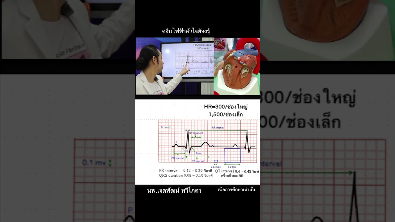 อ่านคลื่นไฟฟ้าหัวใจเบื้องต้น