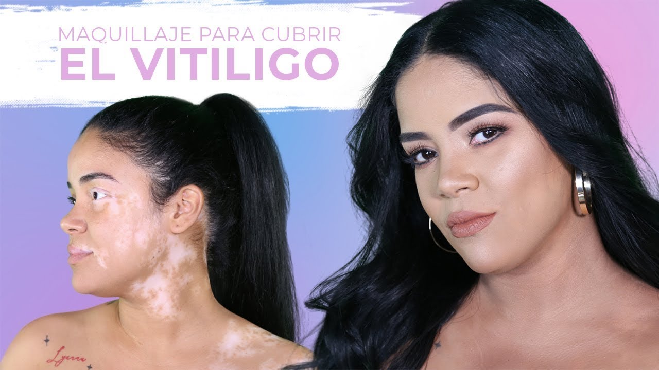 Maquillaje para cubrir El Vitiligo | GyroMakeUp