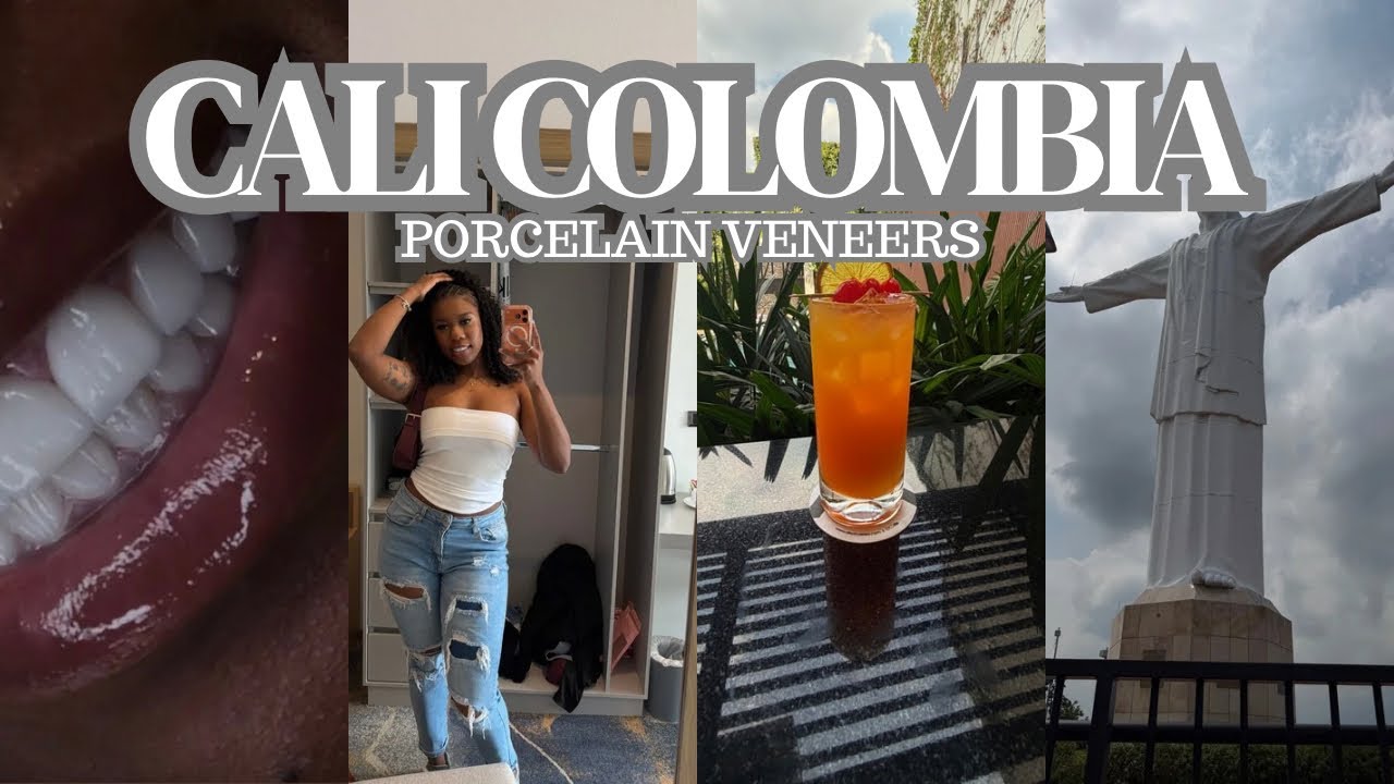 I GOT PORCELAIN VENEERS BY DR VANESSA GIRALDO | HOW MUCH THEY COST? | SOLO TRAVEL