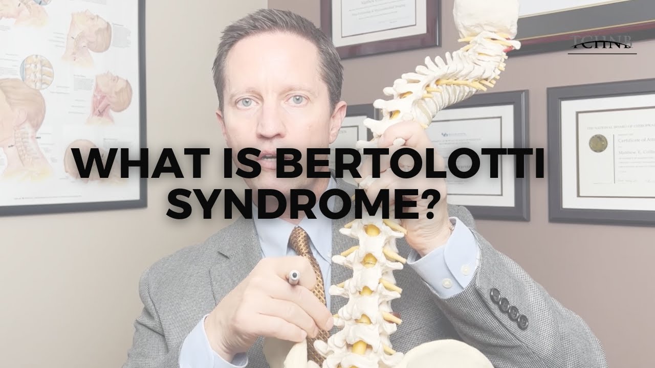 What is Bertolotti Syndrome?