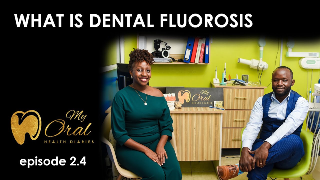 WHAT IS DENTAL FLUOROSIS??