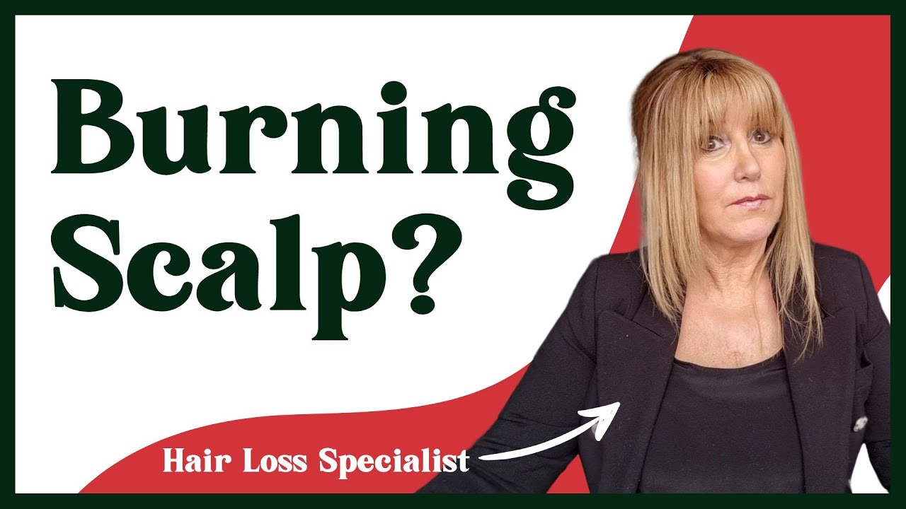 Why is my scalp burning? Why does my scalp hurt when I move my hair?