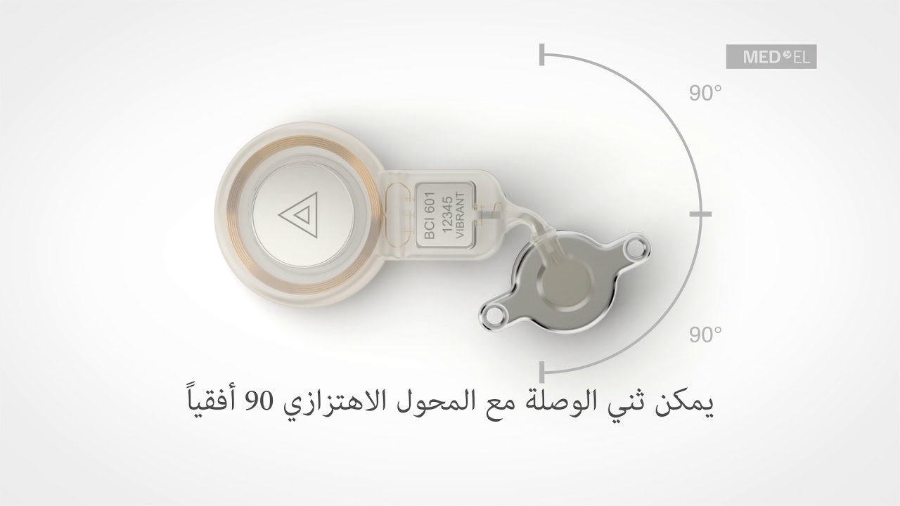 Key Features of the BONEBRIDGE Implant (Arabic)