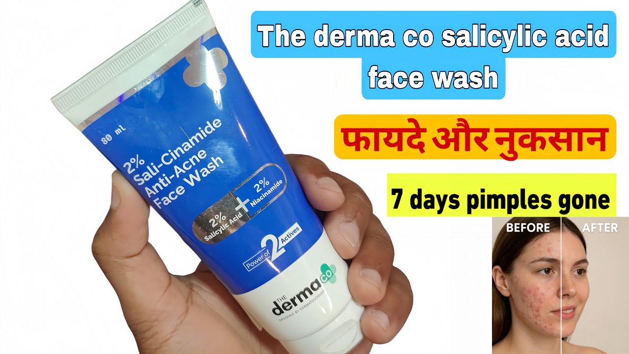 The Derma Co 2% Sali-Cinamide Anti-Acne Face Wash Review in Hindi || Derma Co Facewash 