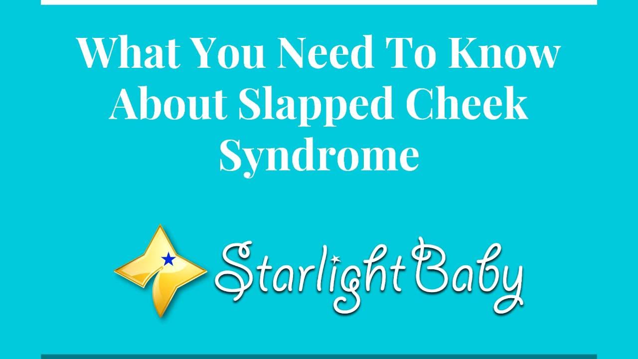 Slapped Cheek Syndrome In Babies - What You Need To Know