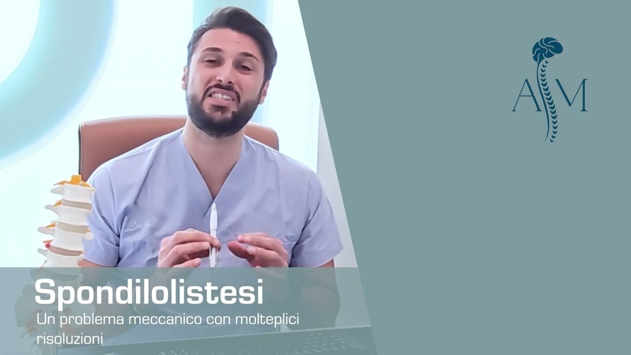 Colpisce la colonna vertebrale: la Spondilolistesi - Dott. Antonio Musio #spondilolistesi