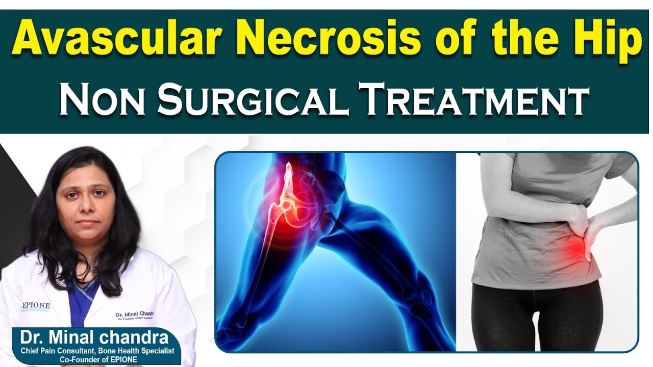 Avascular Necrosis of Hip Treatment Without Surgery || Hip Pain Causes || Hip joint Damage || Epione