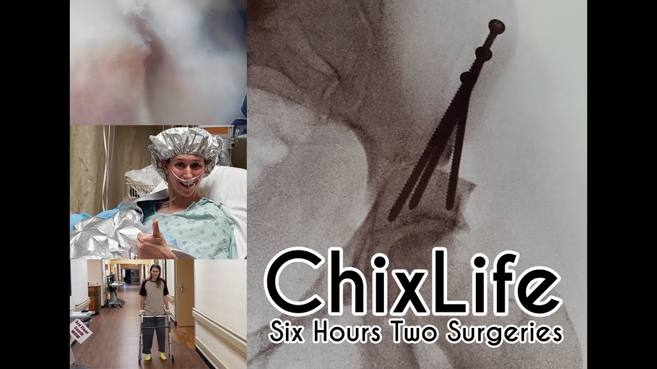 ChixLife: Давайте разрежем ваш таз в 3 местах!