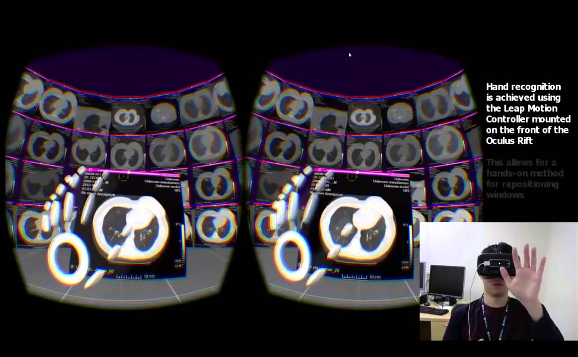 Realidad Virtual para formación en Radiología