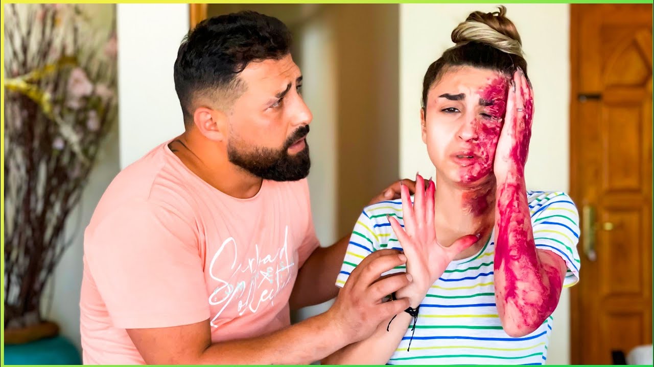 مقلب بزوجي وجهي احترق وتشوه 😱 ردة فعله🔥🔥