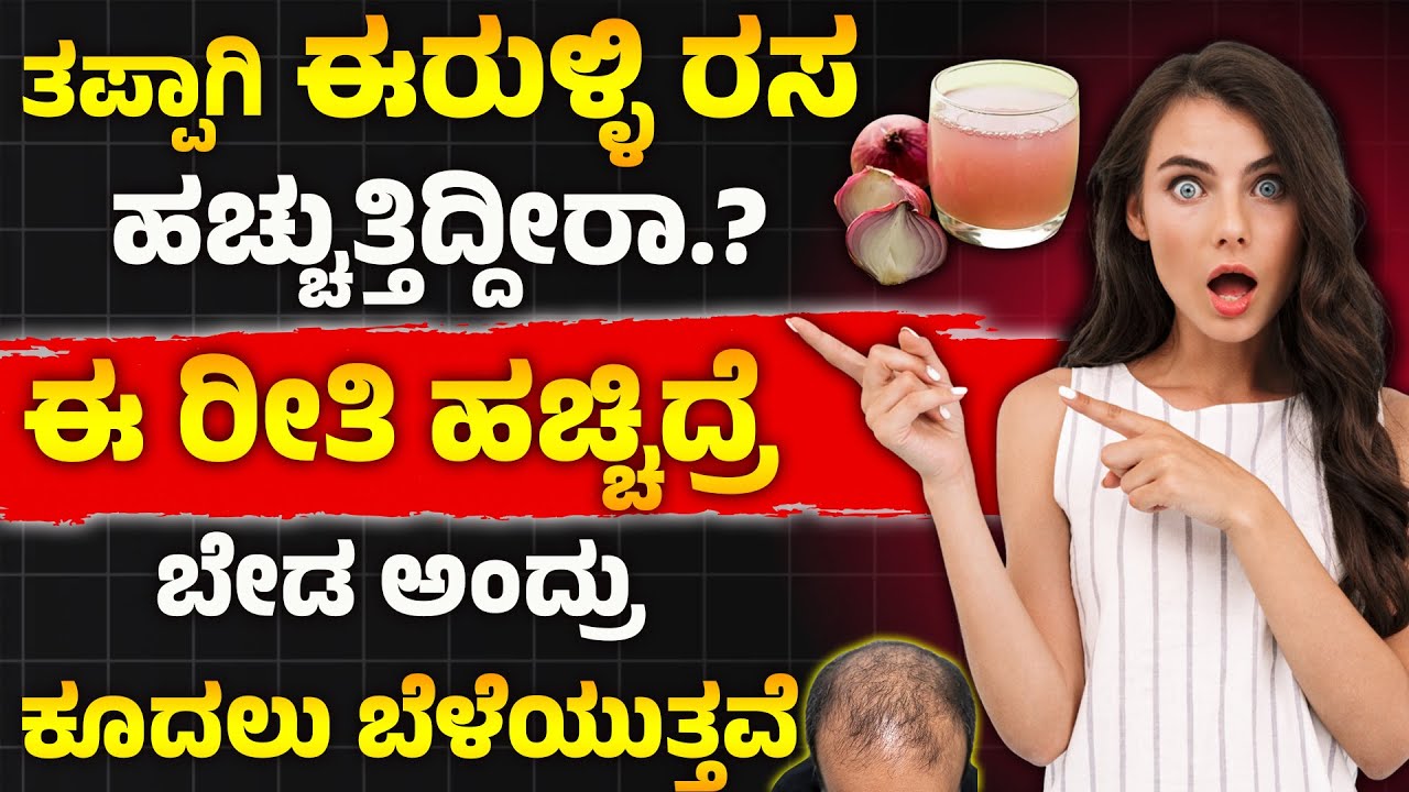 ಈರುಳ್ಳಿ ರಸ ಈ ರೀತಿ ಹಚ್ಚಿದ್ರೆ ಬೇಡ ಅಂದ್ರೂ ಕೂದಲು ಬೆಳೆಯುತ್ತವೆ  | Kudalu Beleyalu Tips | Kudalu Uduruvike