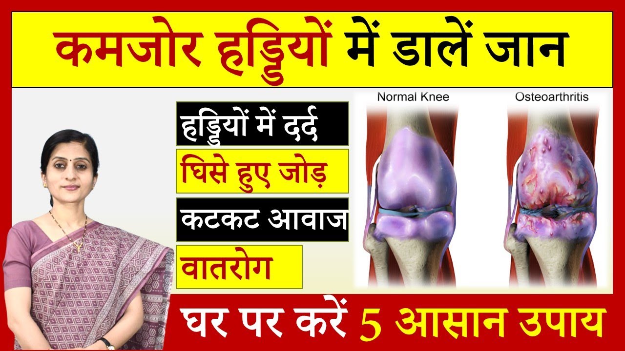 कमजोर हड्डियों में डालें जान  - 5 Effective Ayurvedic Tips for Joint Pain - घर पर करें 5 आसान उपाय