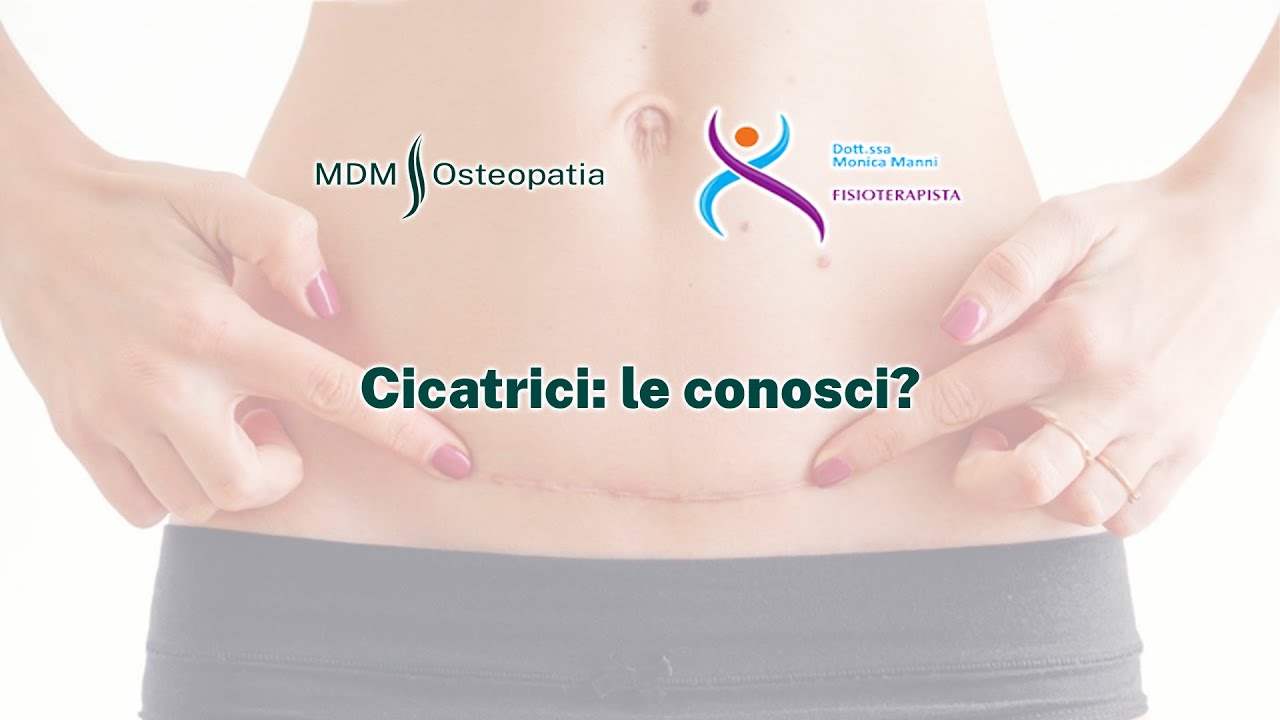 Le cicatrici: le conosci?