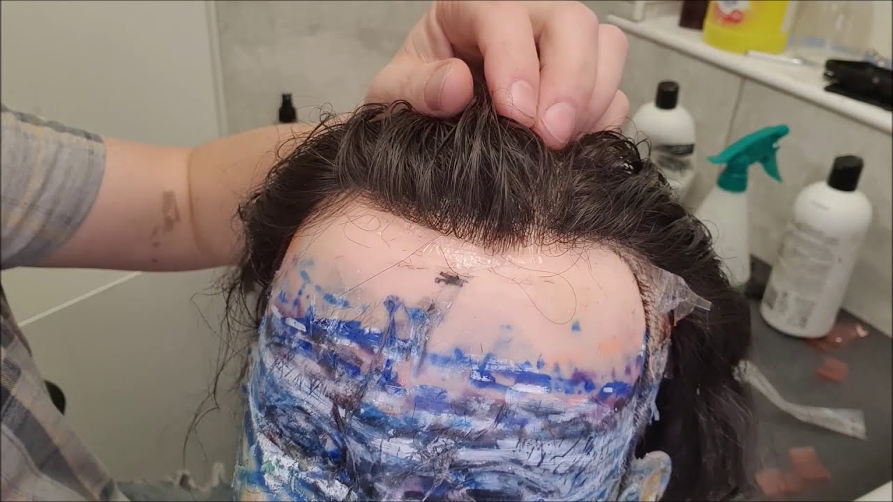 Hair Replacement, Hair System 0.03 poly Skin, How to remove the excess Trim from the hairline