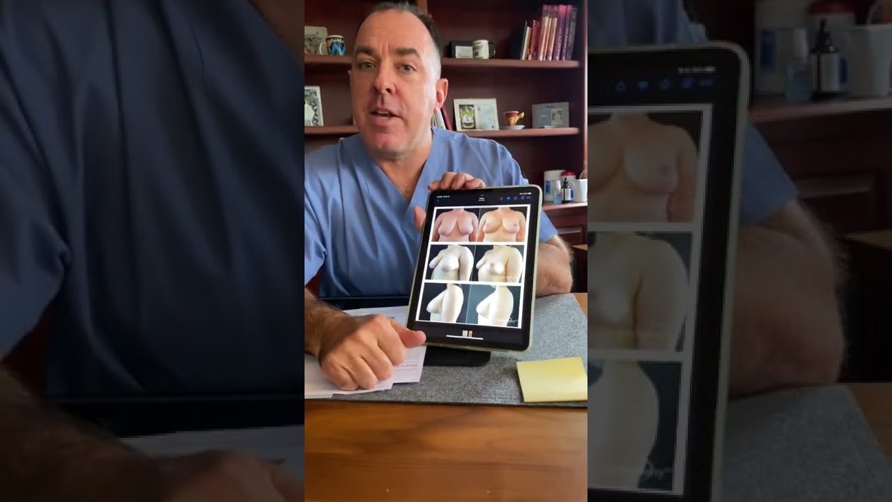 Watch Plastic Surgeon, Dr. Sean Doherty Discuss the Costs of Cosmetic Breast Reduction Surgery