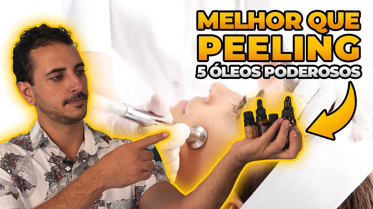MELHOR QUE PEELING - 5 ÓLEOS ESSENCIAIS PODEROSOS PARA MANCHAS, MELASMAS