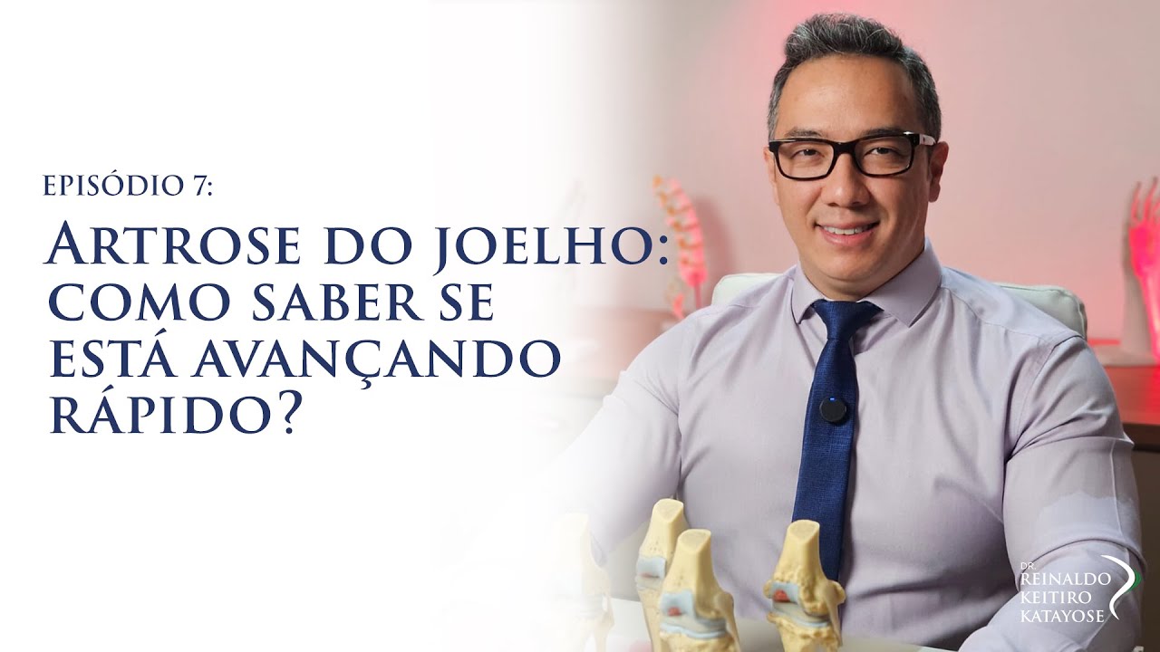 Artrose do joelho: como saber se está avançando rápido?