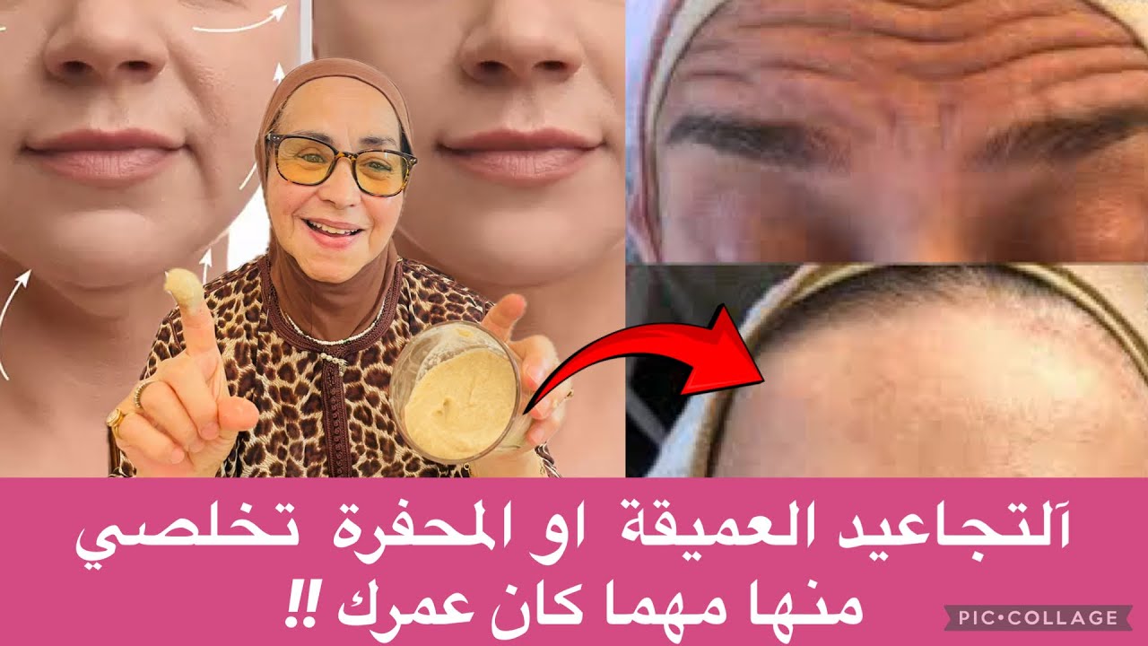 تحدي بنفسك التجاعيد العميقة والمحفرة مهما كان عمرك! جربي هاد الماسك والنتيجة مستحيل تصدقيها