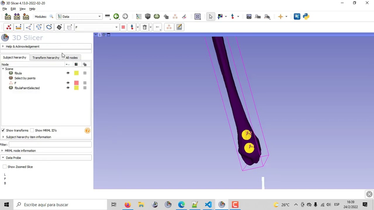 Select By Points Tool, Dynamic Modeler, 3D Slicer