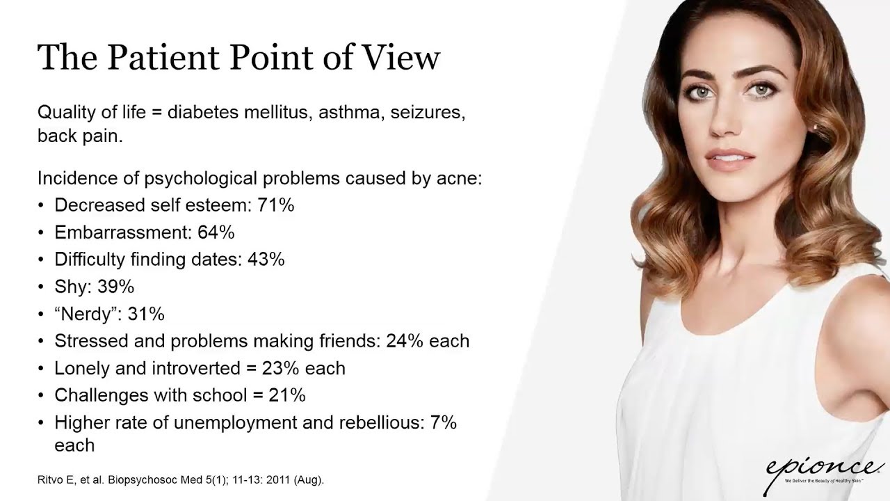 Webinar: Understanding Adult Acne