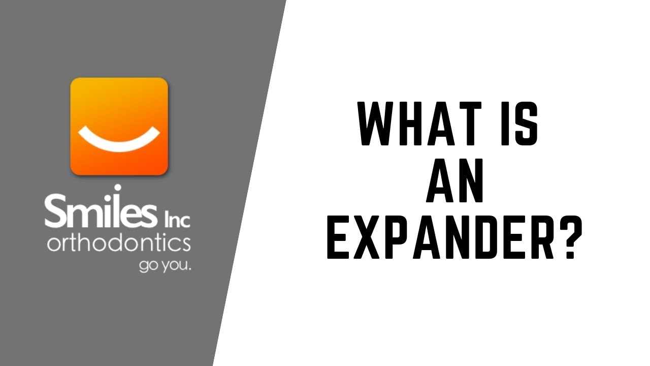 What Exactly Is A Palatal Expander?