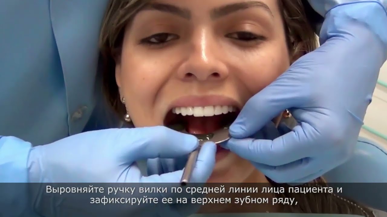 STEP BY STEP: Articulator mounting (Russian Version)