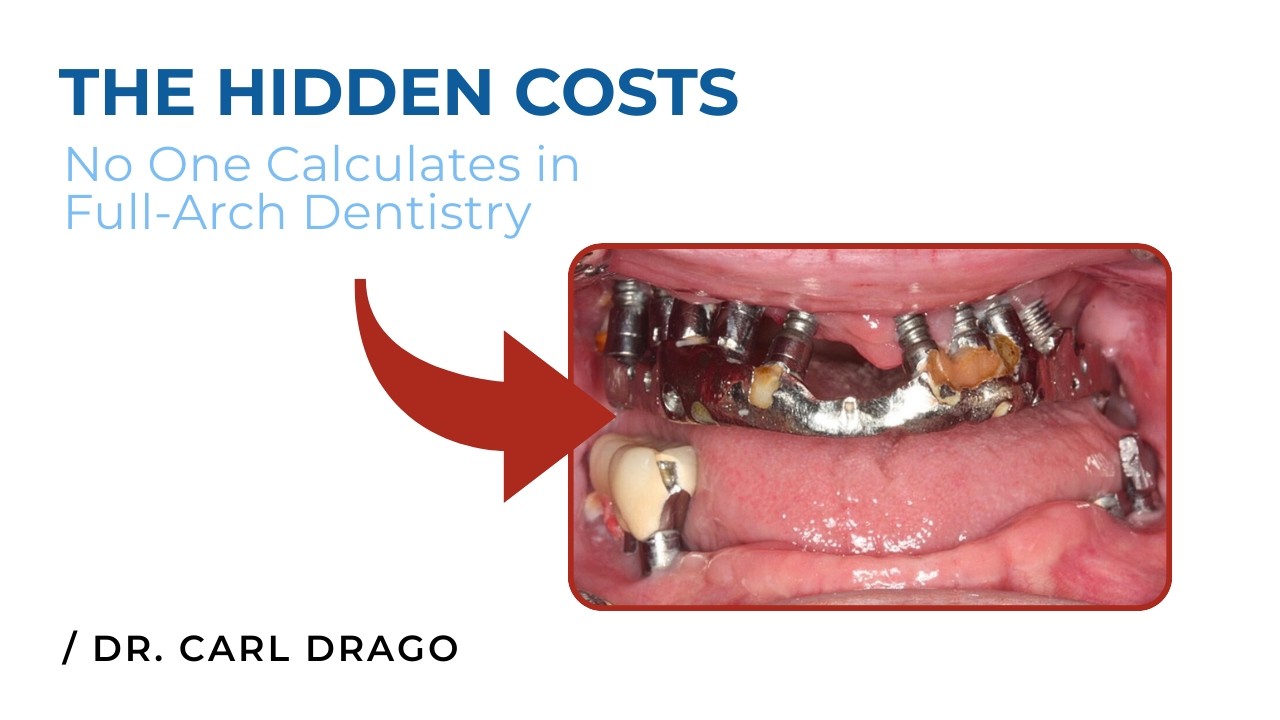 The Hidden Costs No One Calculates in Full-Arch Dentistry | Dr. Carl Drago on Photogrammetry's ROI