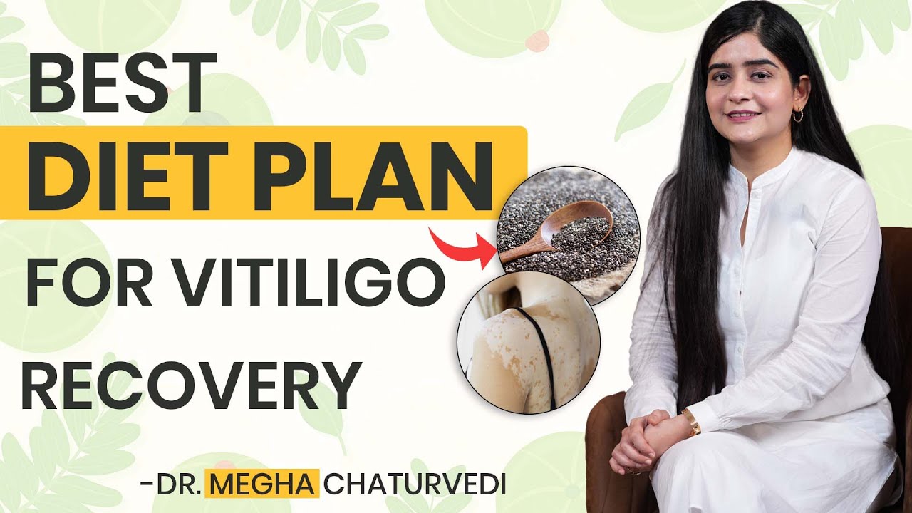 Best Diet Plan for Vitiligo Recovery | Vitiligo Patients Should Eat These Foods | Vitiligo Treatment