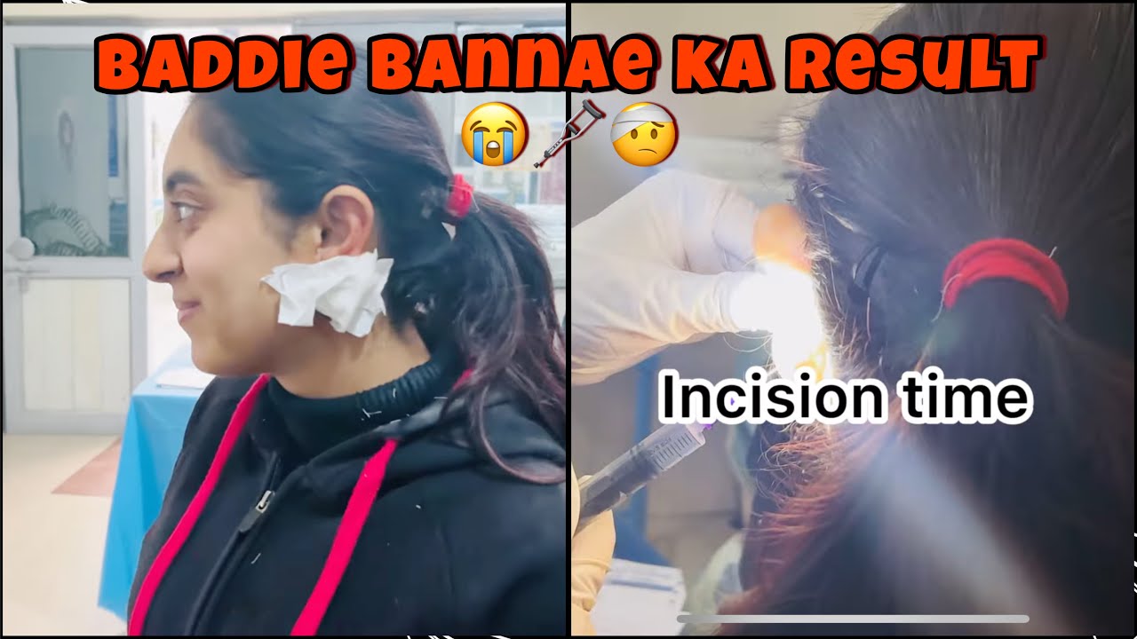 Baddie banke hua popatt😭🤕🩼 