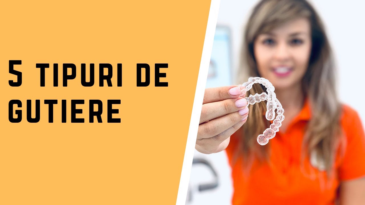 Gutiera de contentie? Gutiera de albire? Cate tipuri de gutiere exista?
