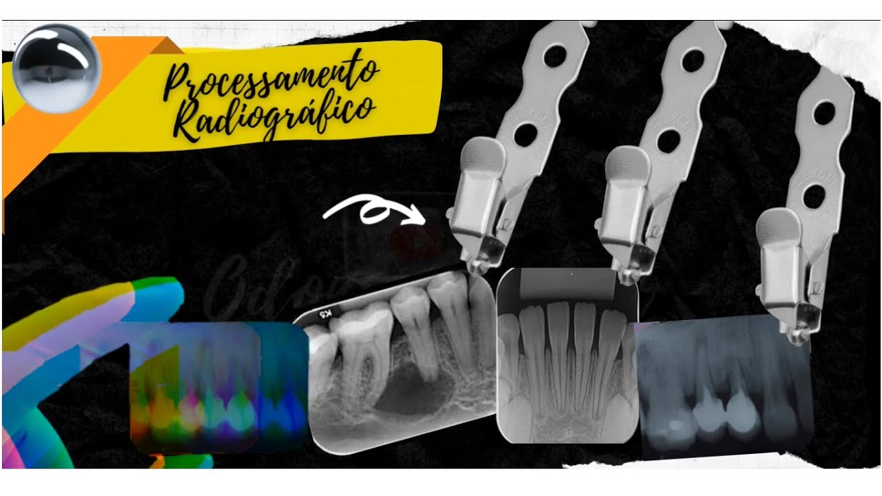 Processamento Radiográfico (